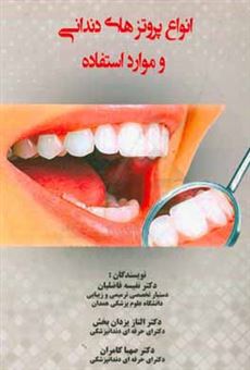 انواع پروتزهای دندانی و موارد استفاده