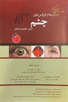 تظاهرات چشمی بیماری های روماتیسمی = Ocular manifestations of rheumatologic disorders