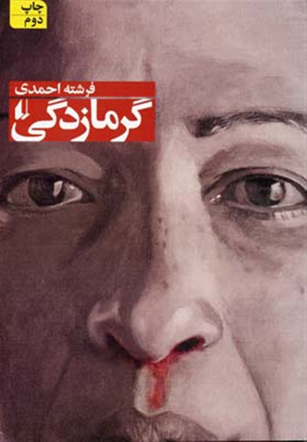 گرمازدگی
