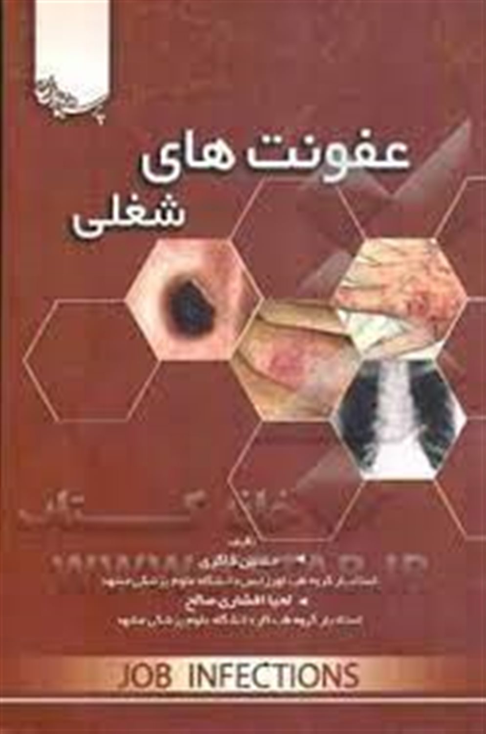 عفونت های شغلی