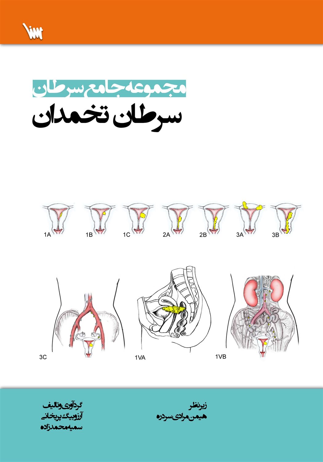 مجموعه جامع سرطان: سرطان تخمدان
