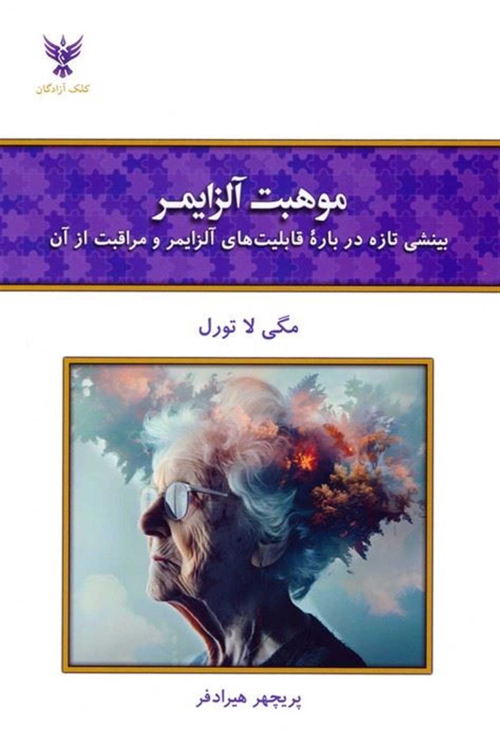 موهبت آلزایمر 
