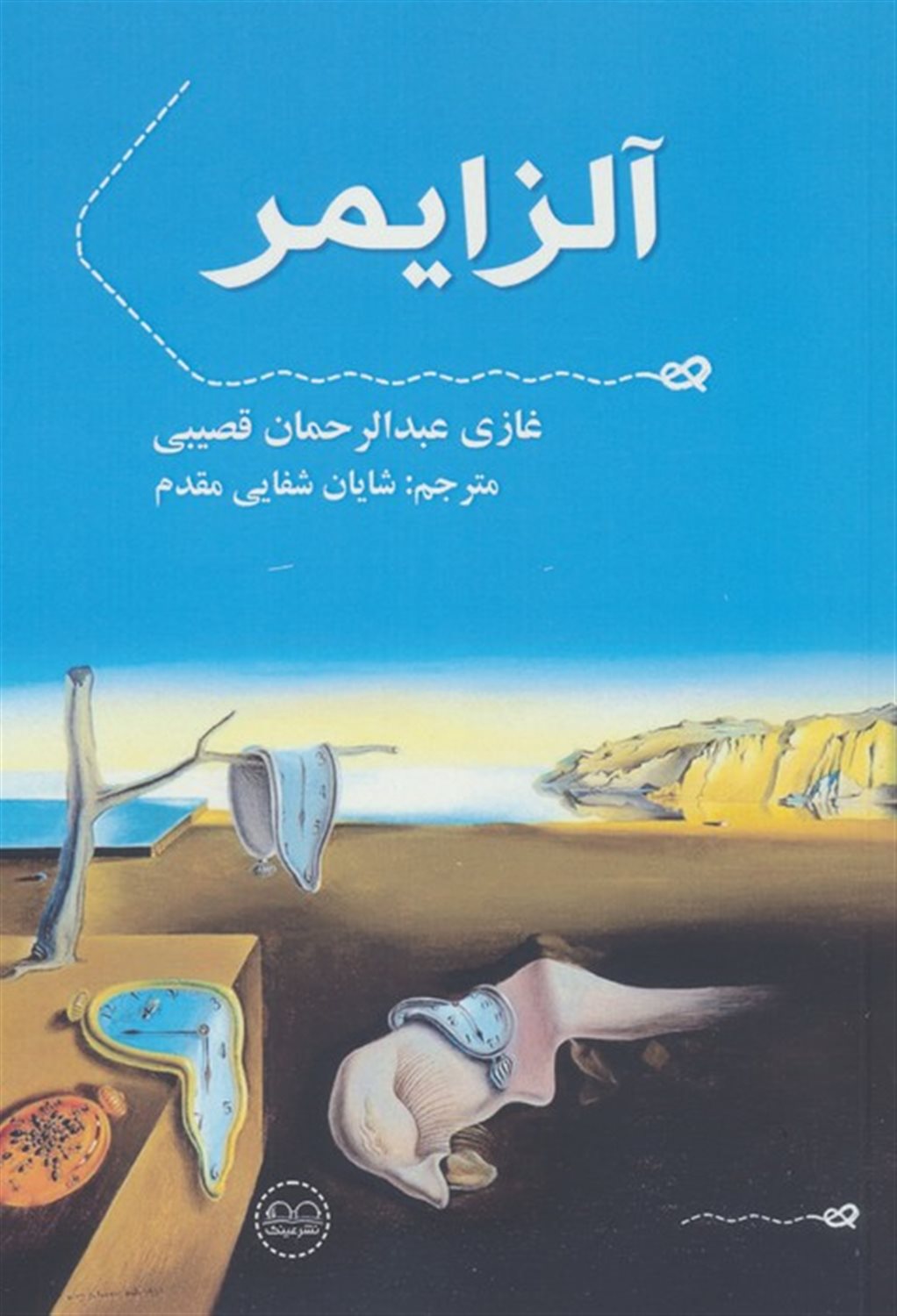 آلزایمر 