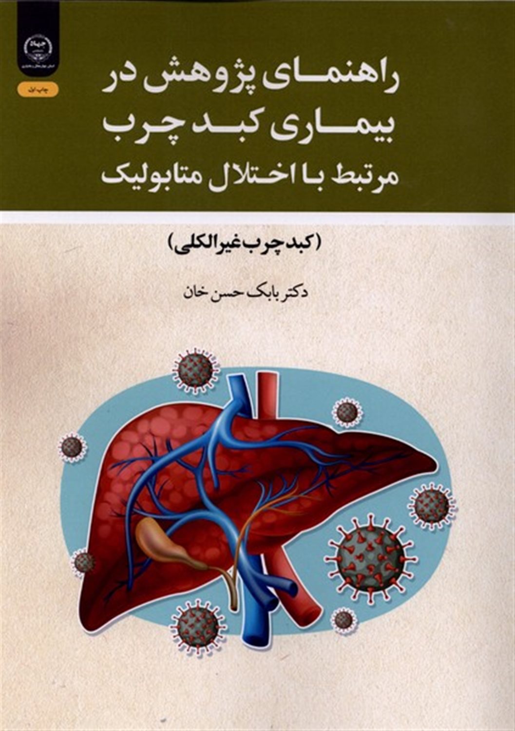 راهنمای پژوهش در بیماری کبد چرب مرتبط با اختلال متابولیک (کبد چرب غیرالکلی)