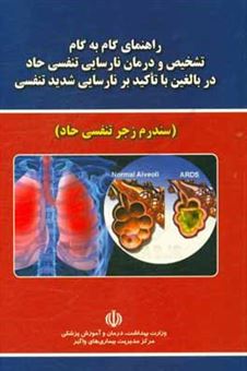 کتاب-راهنمای-گام-به-گام-تشخیص-و-درمان-نارسایی-تنفسی-حاد-در-بالغین-با-تاکید-بر-نارسایی-شدید-تنفسی-سندرم-زجر-تنفسی-حاد-اثر-مجید-مختاری