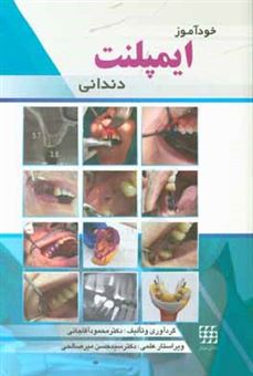 کتاب-خودآموز-ایمپلنت-دندانی