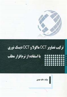 کتاب-ترکیب-تصاویر-oct-ماکولا-و-oct-دیسک-نوری-با-استفاده-از-نرم-افزار-مطلب-اثر-عالیه-عهدی