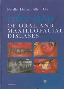 کتاب-color-atlas-of-oral-and-maxillofacial-diseases-اثر-برددبلیو-نویل