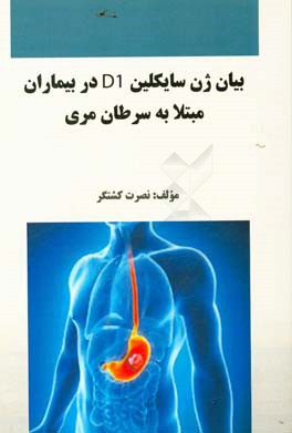 بیان ژن سایکلین D1 در بیماران مبتلا به سرطان مری