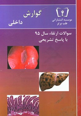 سوالات ارتقاء سال 95 داخلی گوارش