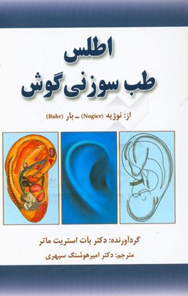 اطلس طب سوزنی گوش از: نوژیه (Nogier) / بار (Bahr)