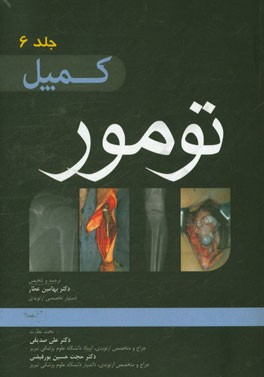 تومور (کمپل 2013)