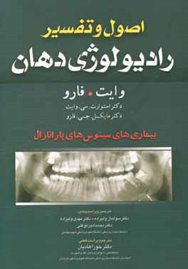 اصول و تفسیر رادیولوژی دهان وایت. فارو: بیماری های سینوس های پارانازال