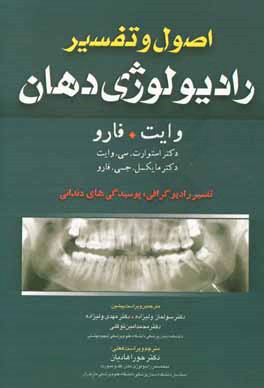 اصول و تفسیر رادیولوژی دهان وایت. فارو: تفسیر رادیوگرافی، پوسیدگی های دندانی