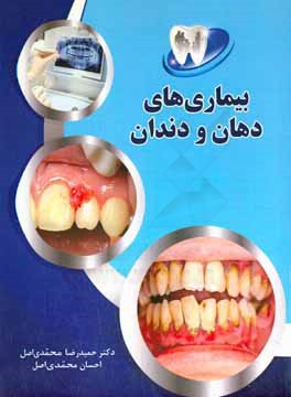 بیماری های دهان و دندان