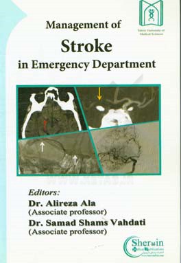 Management of stroke in emergency department