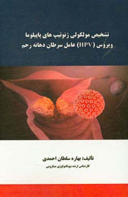 تشخیص مولکولی ژنوتیپ های پاپیلوما ویروس (HPV) عامل سرطان دهانه رحم