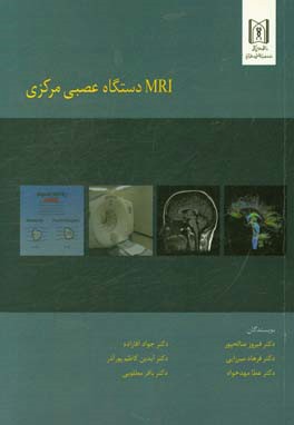 MRI سیستم عصبی مرکزی