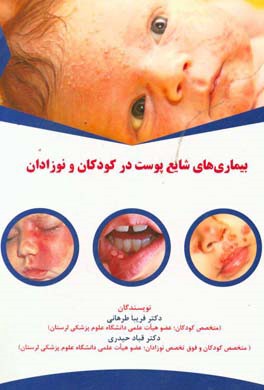 بیماری های شایع پوست در کودکان و نوزادان