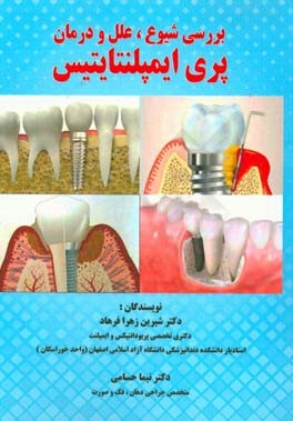 بررسی شیوع، علل و درمان پری ایمپلنتایتس