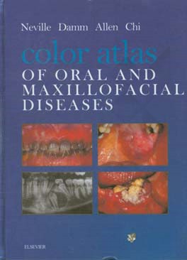 Color atlas of oral and maxillofacial diseases