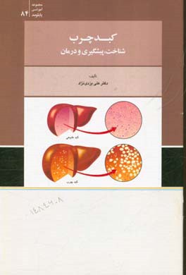 کبد چرب: شناخت، پیشگیری و درمان