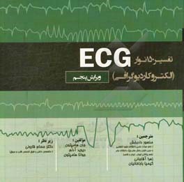 تفسیر 150 نوار ECG (الکتروکاردیوگرافی)