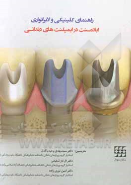 راهنمای کلینیکی و لابراتواری اباتمنت در ایمپلنت های دندانی