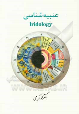 عنبیه شناسی (Iridology)