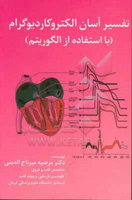 تفسیر آسان الکتروکادیوگرام با استفاده از الگوریتم